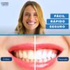 Blanqueamiento Dental Antes y Despues